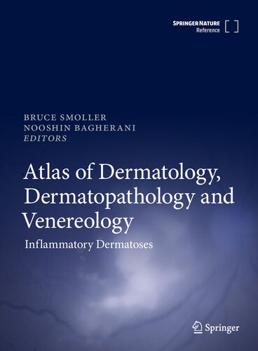 Atlas of Dermatology, Dermatopathology and Venereology: Inflammatory Dermatoses