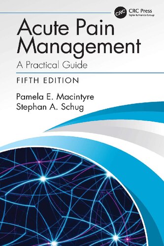 Acute Pain Management A Practical Guide
