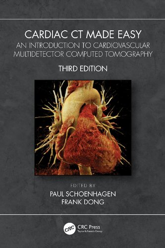 CARDIAC CT MADE EASY an introduction to cardiovascular multidetector.