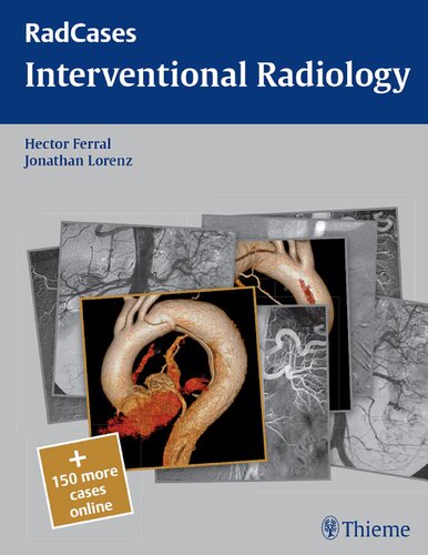 Radcases Interventional Radiology (Radcases Plus Q&A)