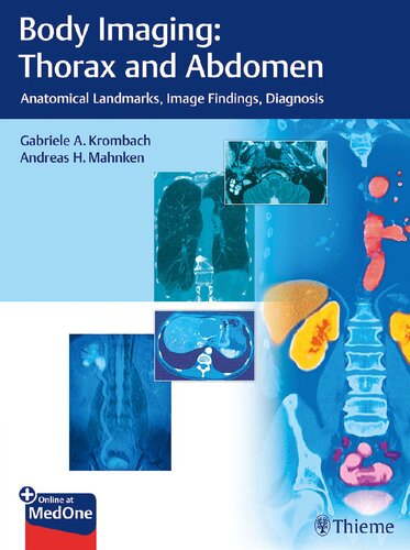 Body Imaging: Thorax and Abdomen: Anatomical Landmarks, Image Findings, Diagnosis
