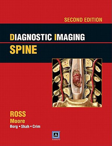 Diagnostic Imaging: Spine (Diagnostic Imaging Series)