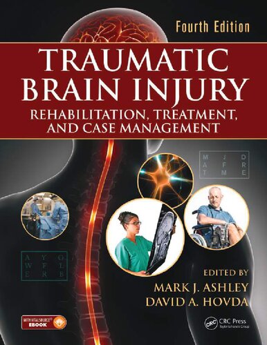 Traumatic Brain Injury: Rehabilitation, Treatment, and Case Management