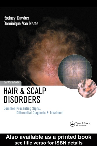 Hair and scalp disorders: common presenting signs, differential diagnosis, and treatment