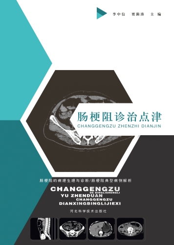肠梗阻诊治点津