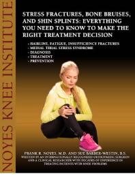 Stress Fractures, Bone Bruises, and Shin Splints : Everything You Need to Know to Make the Right Treatment Decision