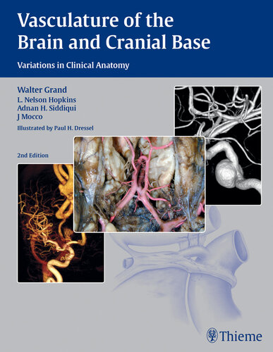 Vasculature of the brain and cranial base : variations in clinical anatomy