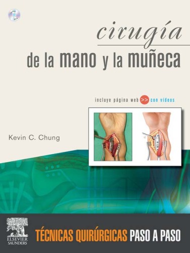 Cirugía de la mano y la muñeca