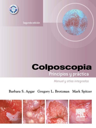 Colposcopia. Principios y práctica: Manual y atlas integrados