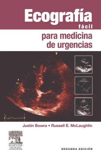 Ecografía fácil para medicina de urgencias