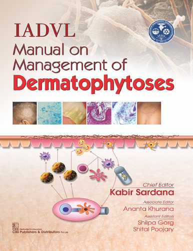 IADVL Manual on Management of Dermatophytoses