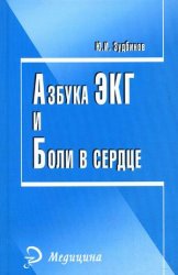Азбука ЭКГ и боли в сердце