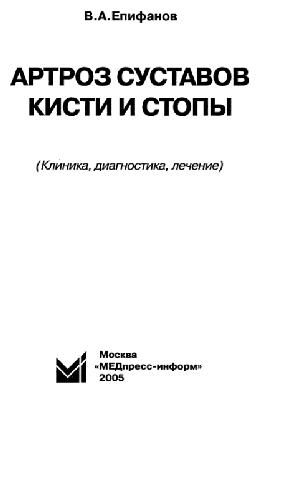 Артроз суставов кисти и стопы