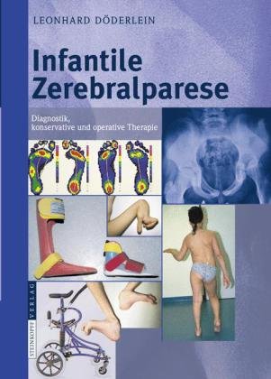 Infantile Zerebralparese: Diagnostik, konservative und operative Therapie