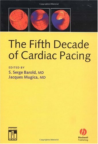 The fifth decade of cardiac pacing