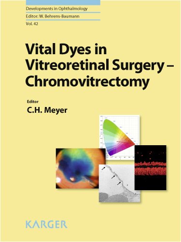 Vital Dyes in Vitreoretinal Surgery: Chromovitrectomy (Developments in Ophthalmology, Vol. 42)
