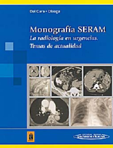 Monografía SERAM: La Radiologia en Urgencias. Temas de Actualidad