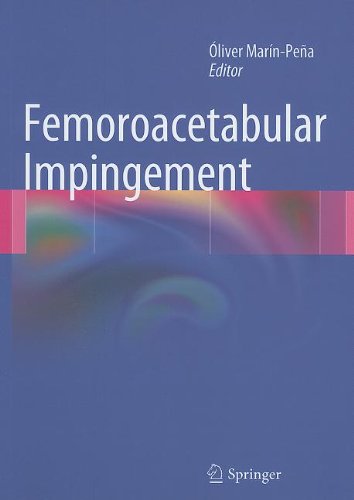 Femoroacetabular Impingement