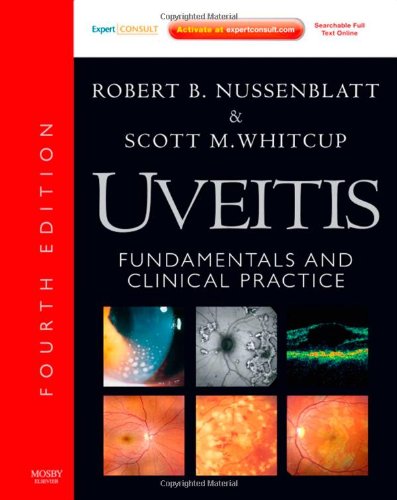 Uveitis: Fundamentals and Clinical Practice: Expert Consult - Online and Print, Fourth Edition