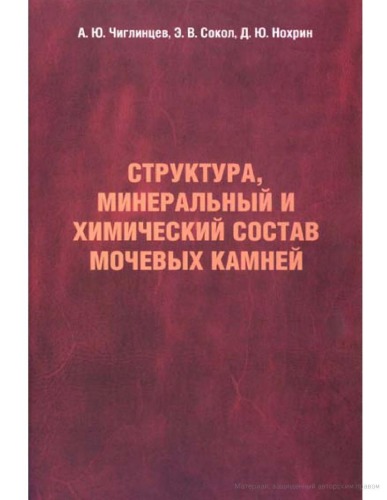 Структура, минеральный и химический состав мочевых камней