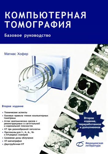 Компьютерная томография. Базовое руководство.